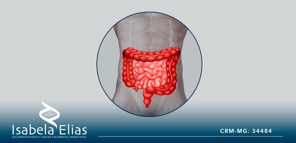 Como é o tratamento minimamente invasivo do câncer colorretal