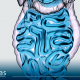 Endometriose intestinal: quando recorrer à cirurgia?